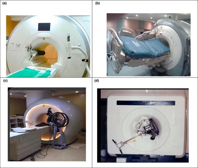 Examples of projectile accidents in the MRI environment: (A) oxygen cylinder, (B) stretcher bed, (C) wheelchair, (D) floor buffer. (Images courtesy of, and reprinted with permission from, Frank G. Shellock, Ph.D., www.MRIsafety.com).